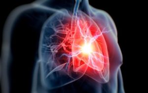 doenças crônicas e saúde cardiovascular