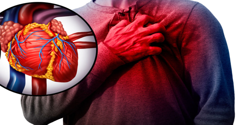 Aterosclerose: o que é e por que importa?
